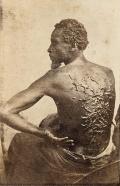 БРЭДИ, Мэттью. Раб, подвергнутый наказанию. 1863 г. 